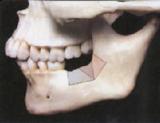 Knoche1